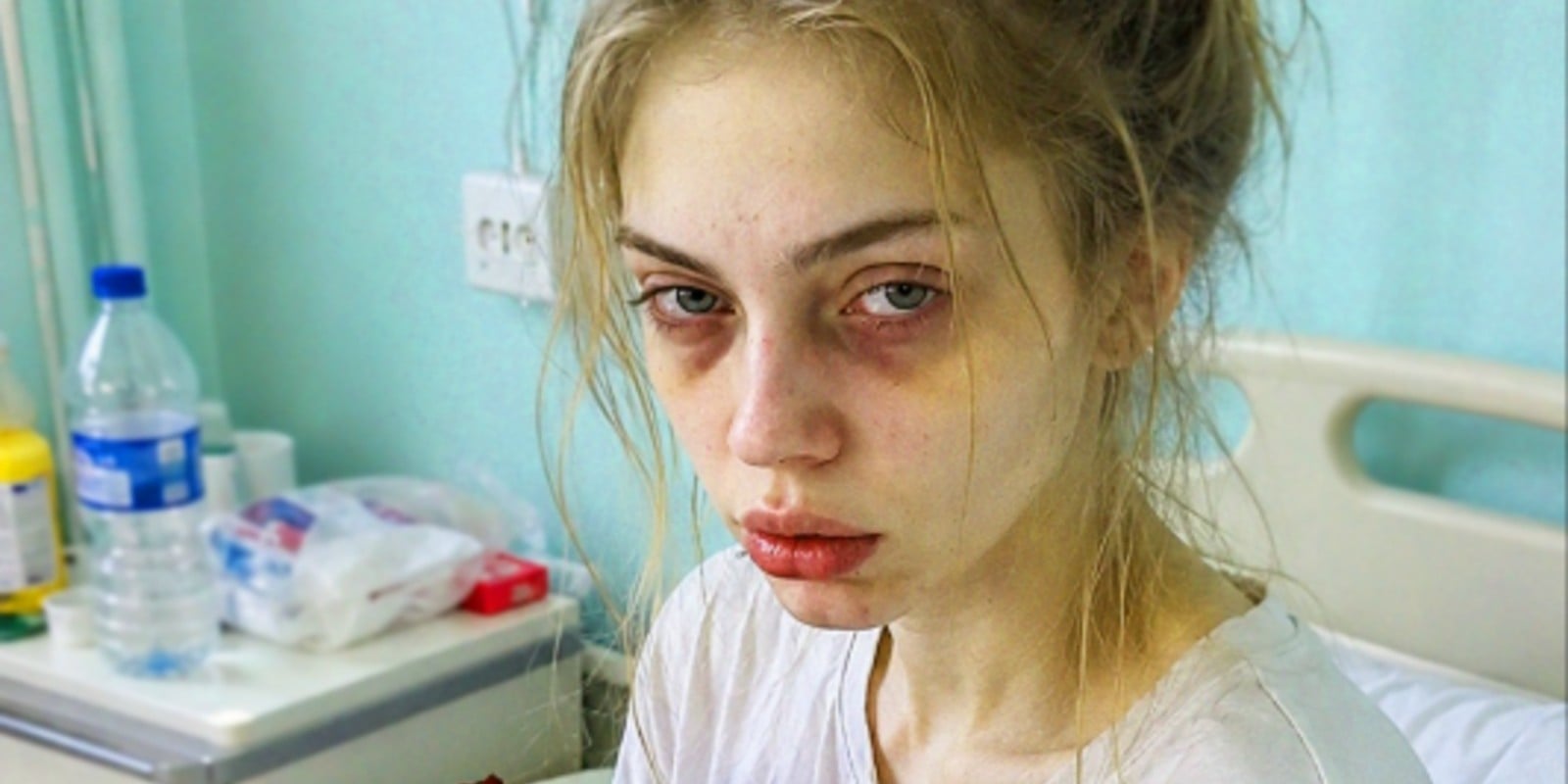 Моя 18-летняя дочь умерла и стала донором органов, но сразу после прощания врач догнал меня в коридоре и раскрыл тайну, которую мой муж умолял скрывать от меня до самого конца